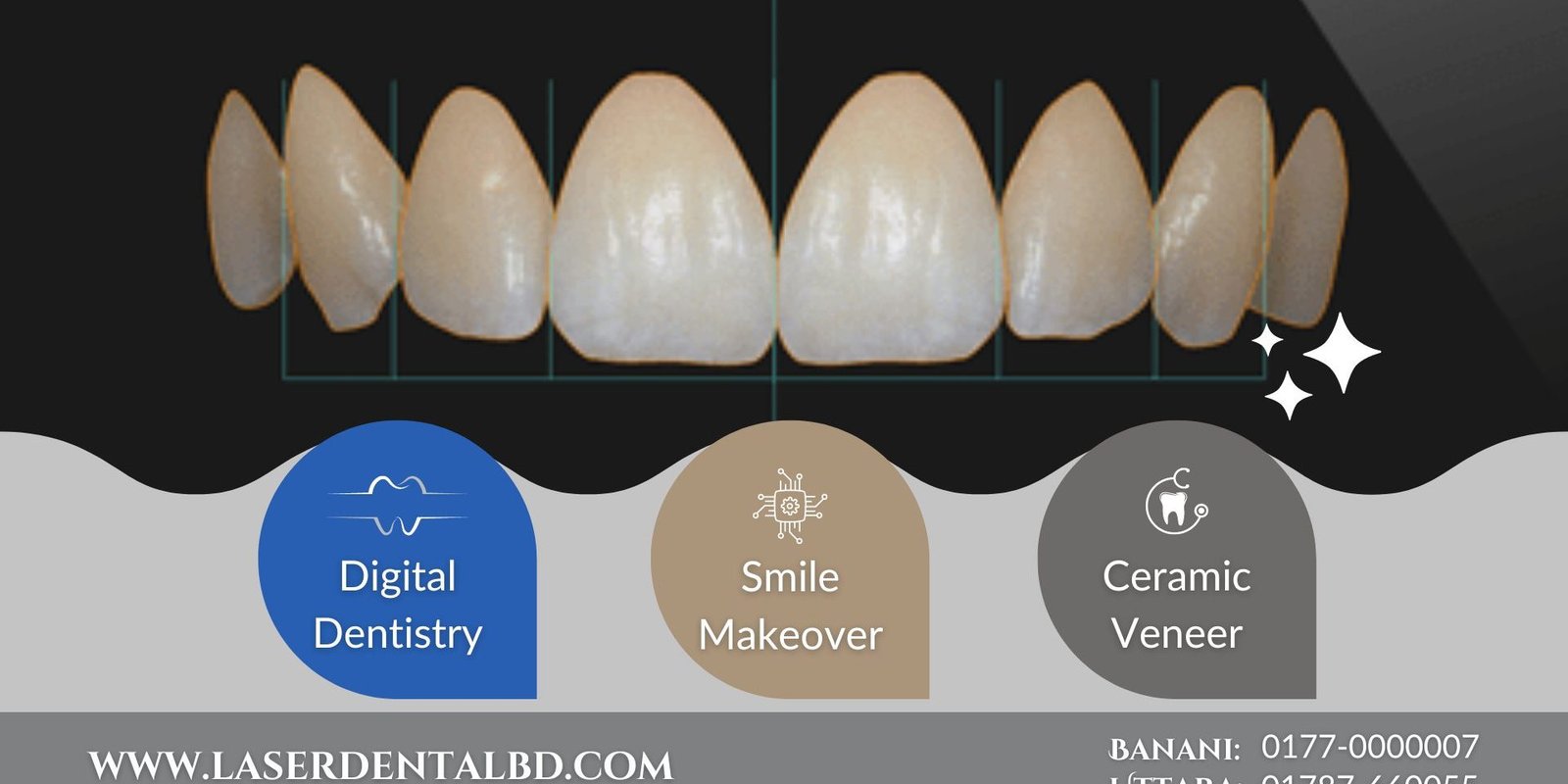 Digital dentistry in Bangladesh-cosmetic dentist-teeth veneer-teeth whitening-invisalign Digital dentistry in Bangladesh