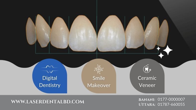 Digital dentistry in Bangladesh-cosmetic dentist-teeth veneer-teeth whitening-invisalign Digital dentistry in Bangladesh