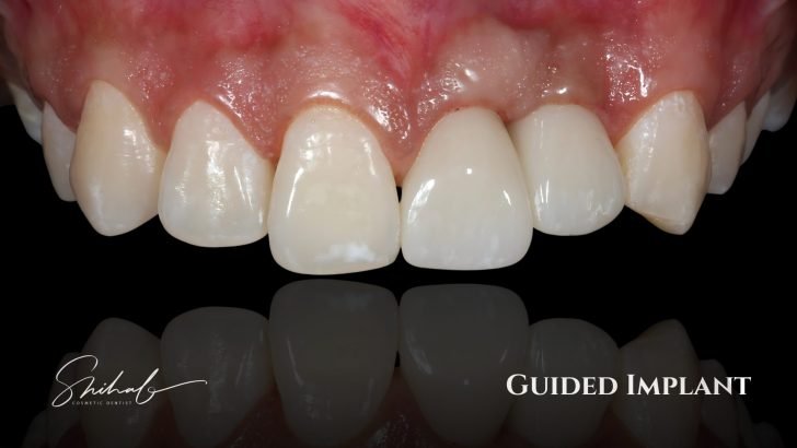Digital dentistry in Banani, Gulshan