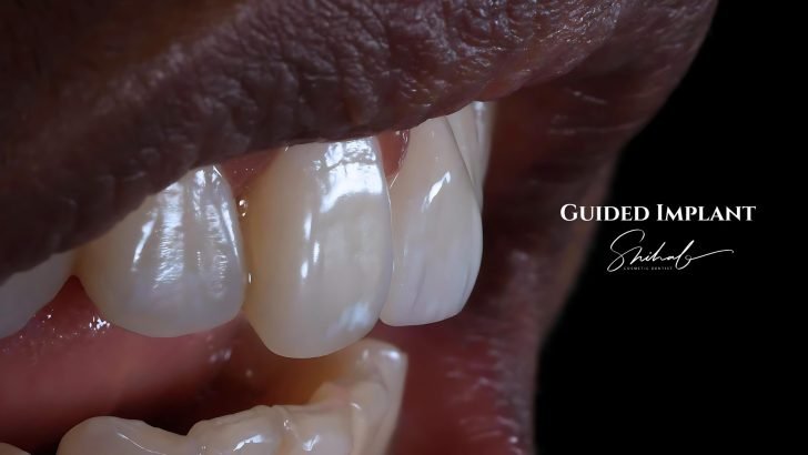 Cosmetic dentist in Banani, Gulshan, Dhanmondi and Uttara