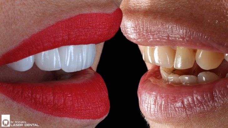 Digital Smile Design (DSD) Preview – Customized Cosmetic Dentistry at LASER DENTAL, Banani