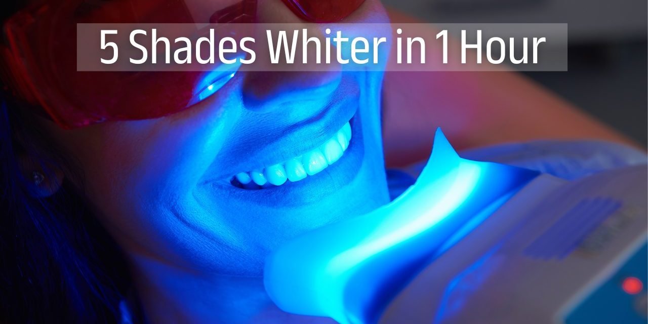 philips-zoom-teeth-whitening-dhaka Brighter Smile, Instantly