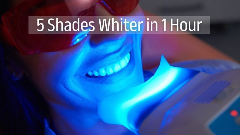 philips-zoom-teeth-whitening-dhaka Brighter Smile, Instantly