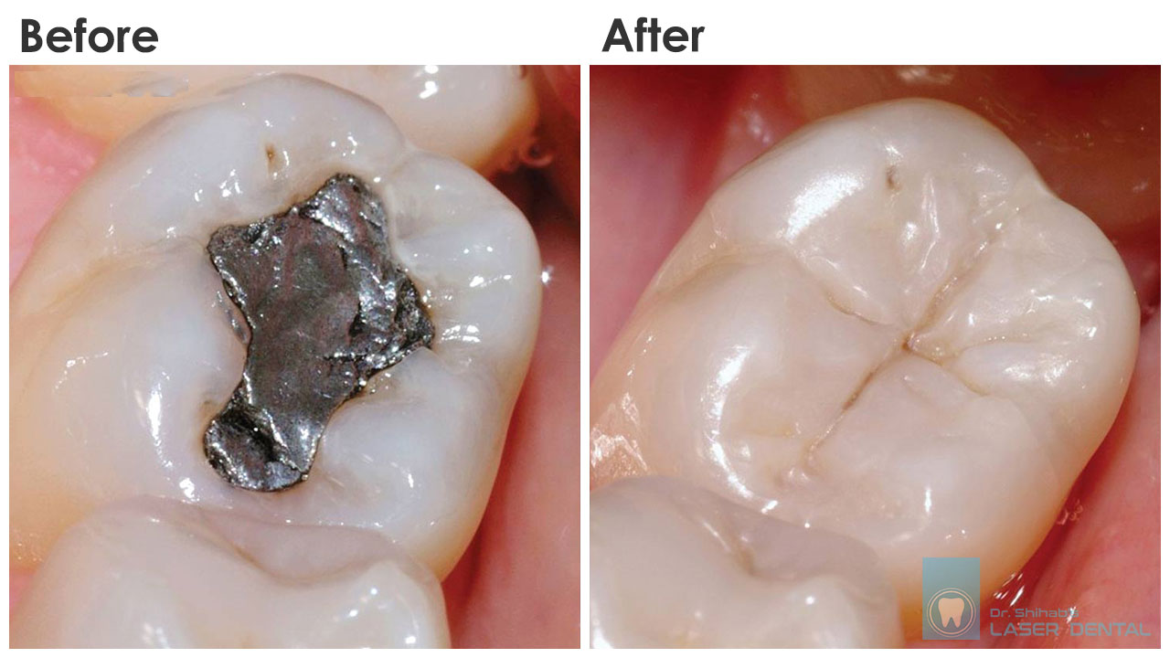 Gallery LASER DENTAL Best Dental Clinic in Bangladesh