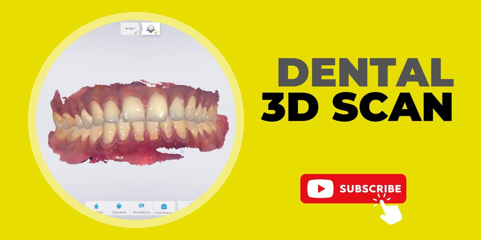 3D Dental Scan | A New Era in Digital Dentistry