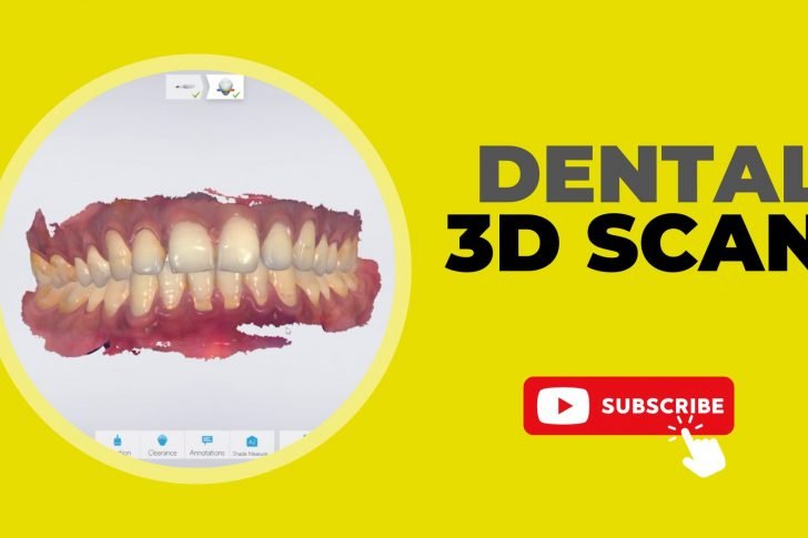 3D Dental Scan | A New Era in Digital Dentistry