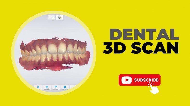 3D Dental Scan | A New Era in Digital Dentistry