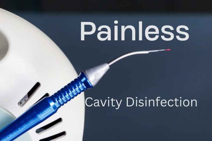 Safe & Modern Cavity Care