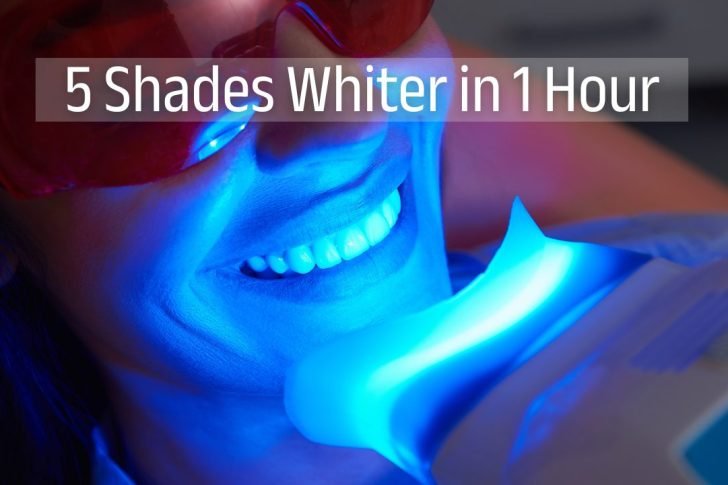 Brighter Smile, Instantly